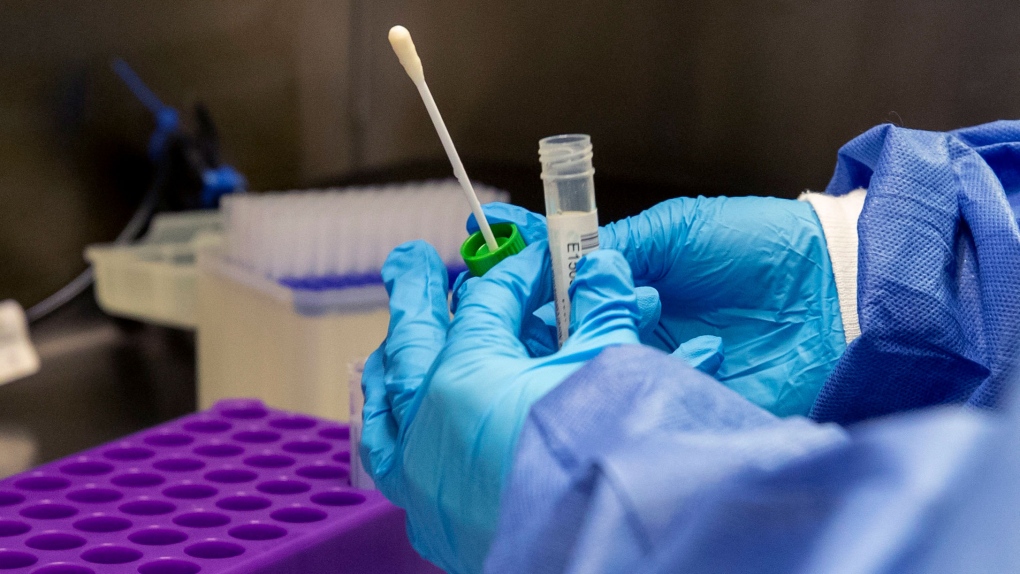 FDA warns UK coronavirus variant may result in false-negative&nbsp;tests