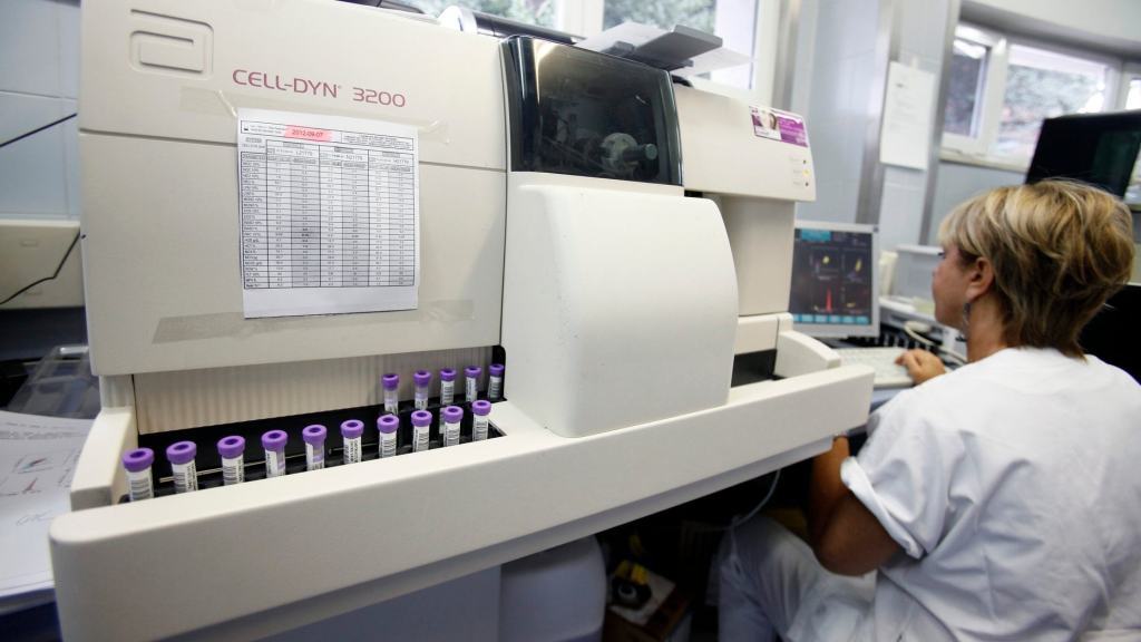 Is your baby formula making your infant sick? Signs to watch&nbsp;for