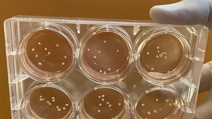 COVID-19 may increase risk of Alzheimer’s, Parkinson’s, stroke:&nbsp;study